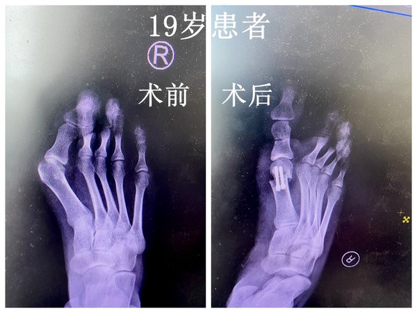 19岁.jpg