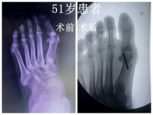 51岁.jpg