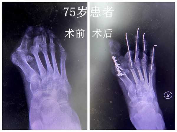 75岁.jpg